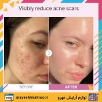 سرم نیاسینامید کوزارکس-COSRX Niacinamide Face Serum-لوازم آرایش اورجینال مهرو