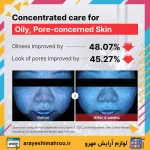 سرم نیاسینامید کوزارکس-COSRX Niacinamide Face Serum-لوازم آرایش اورجینال مهرو