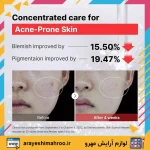 سرم نیاسینامید کوزارکس-COSRX Niacinamide Face Serum-لوازم آرایش اورجینال مهرو